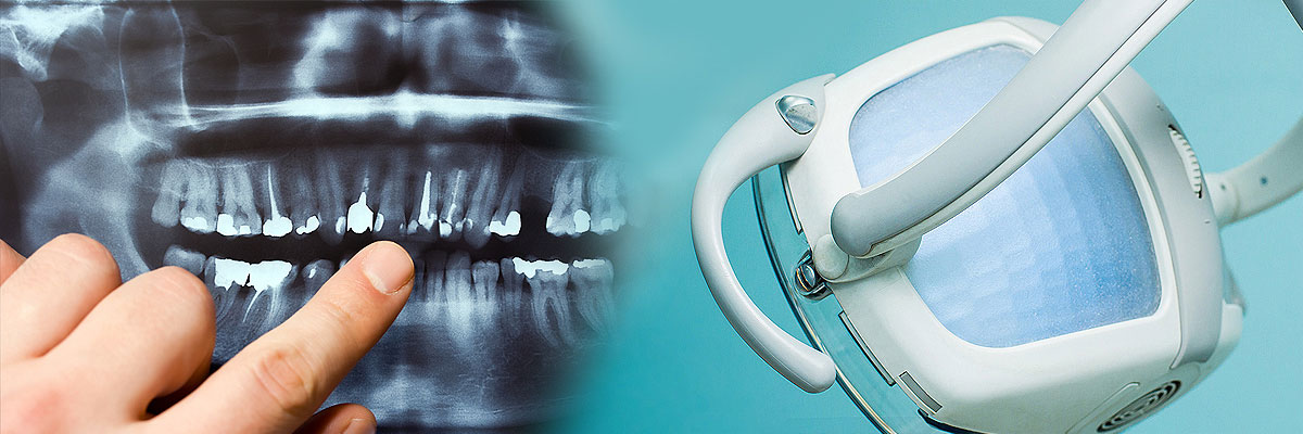 Brandon Dental Cleaning