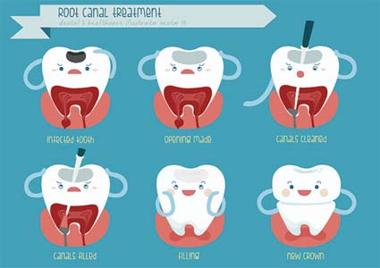 Endodontics