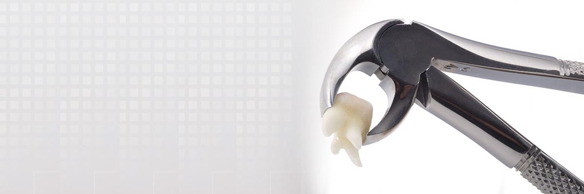 Brandon Tooth Extraction
